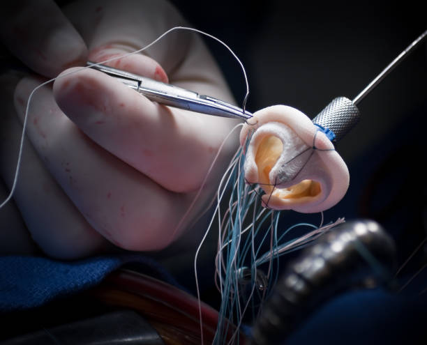 Cardiac Valve Replacement