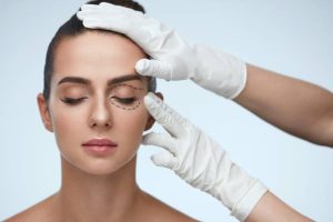 Blepharoplasty (Eyelids)
