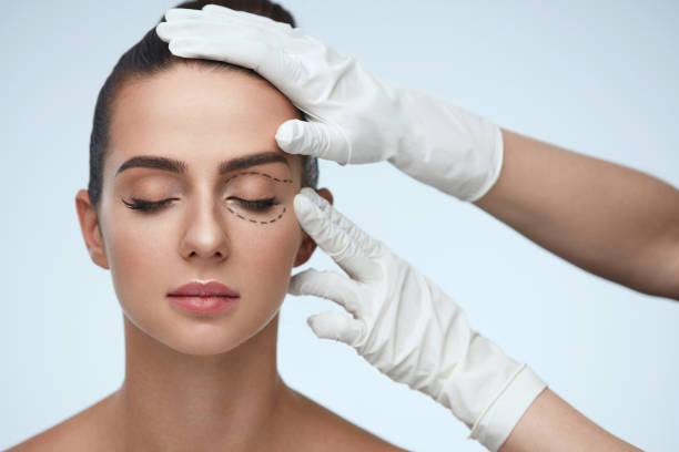 Blepharoplasty (Eyelids)