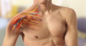 Brachial Plexus Injuries/Stereotactic Procedures