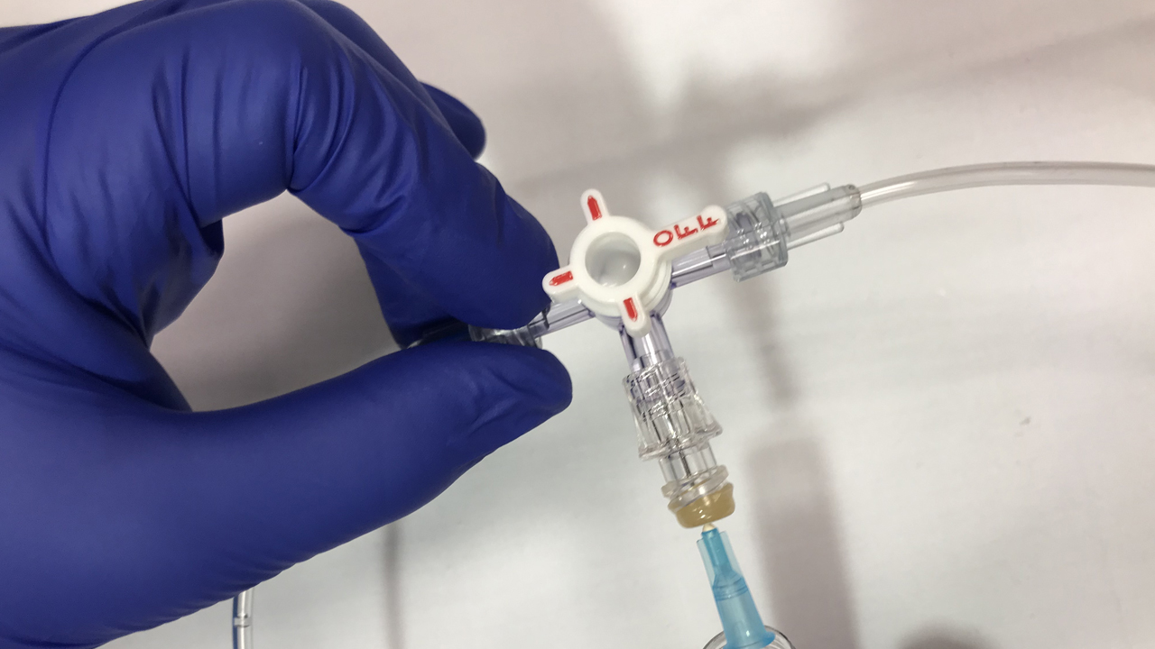 External Ventricular Drainage