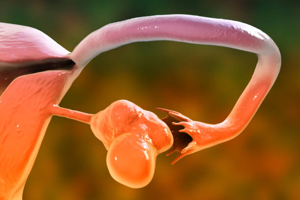 Polycystic Ovarian Syndrome (PCOS) Treatment