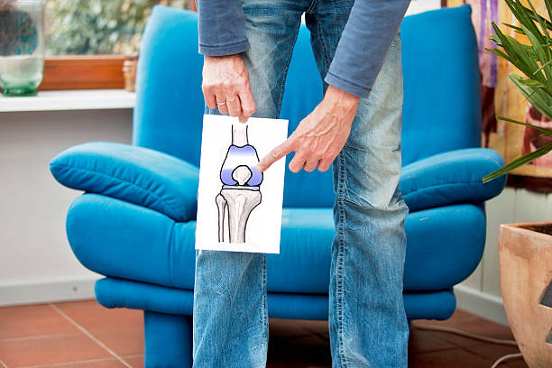 Total Knee Replacement B/L