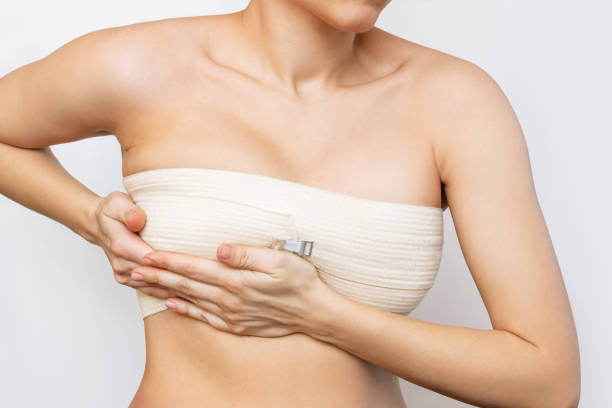 Breast Reconstruction Surgery