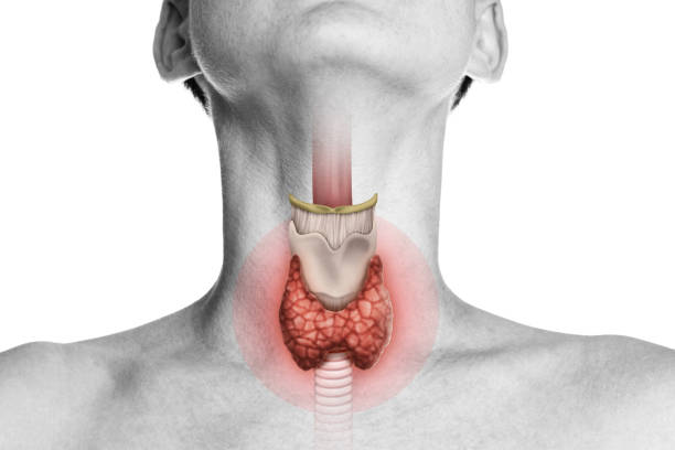 Thyroidectomy