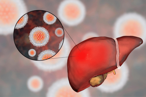 Liver Cancer Treatment
