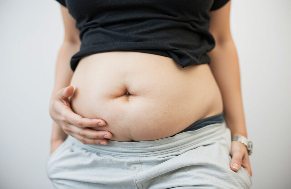Belly Fat and COVID-19 Deaths: New Tailored Treatments on the Horizon