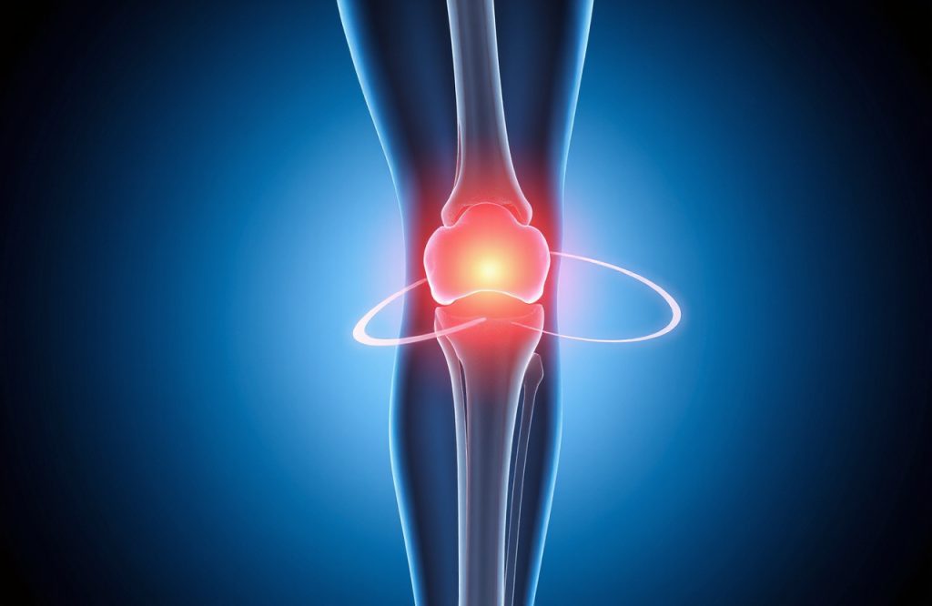 Breakthrough Treatment Offers Hope in Stopping Knee Osteoarthritis