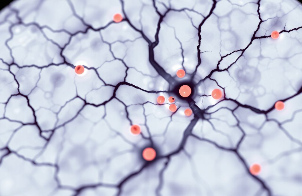 Uncovering Cardiovascular Disease Markers That Indicate Microscopic Strokes