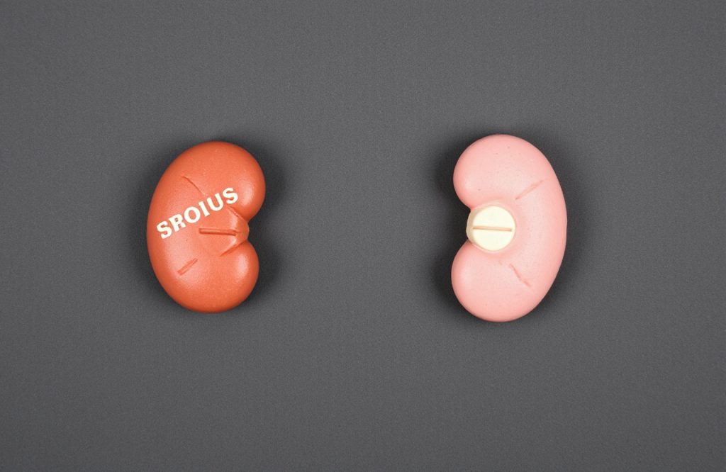 Exploring the Link Between Acid Reflux Medication and Kidney Disease Risk