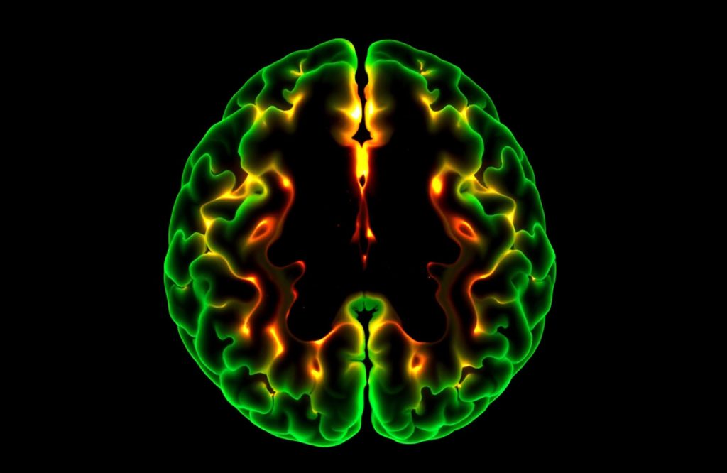 Gadolinium Accumulation in the Brain: Implications of Repeated MRI Scans