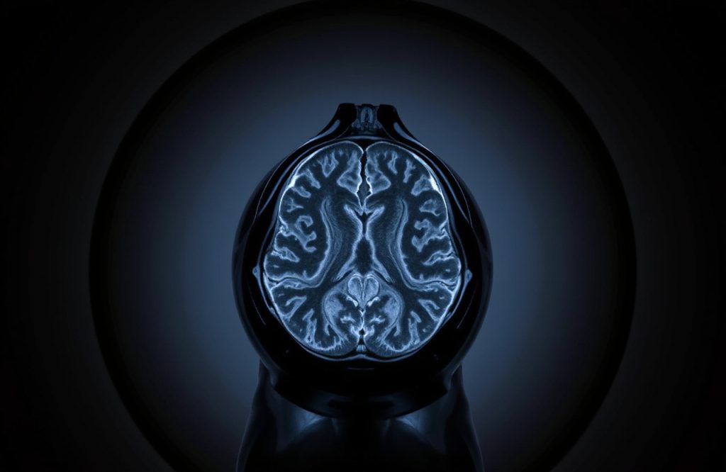 Revolutionary MRI Contrast Agent Promises Safer Imaging Solutions Than Current Options