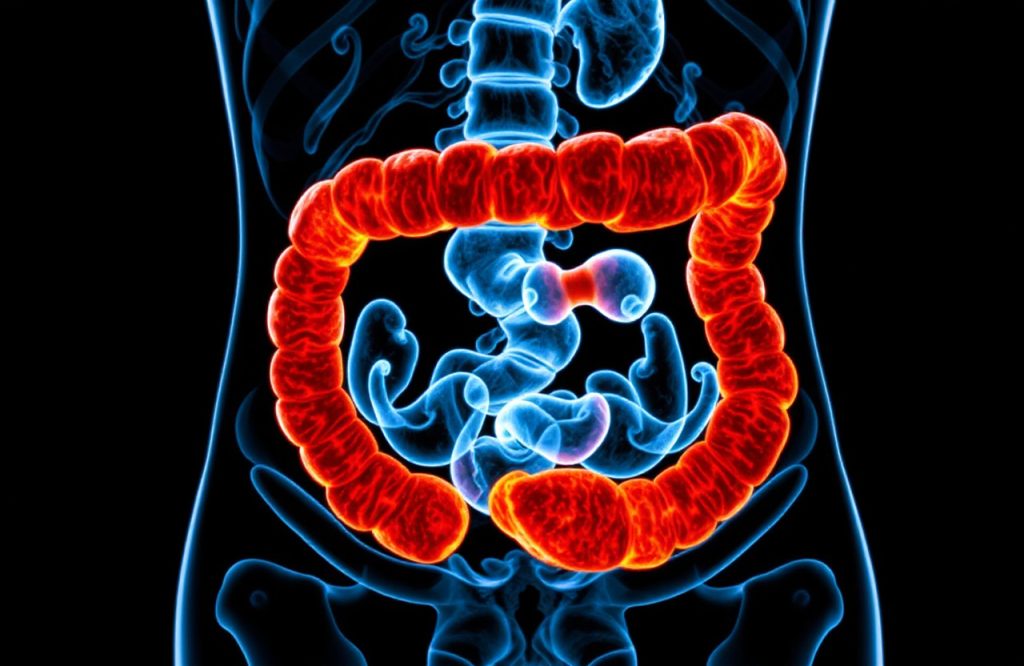 Revolutionary Diagnosis Method for Inflammatory Bowel Disease Unveiled