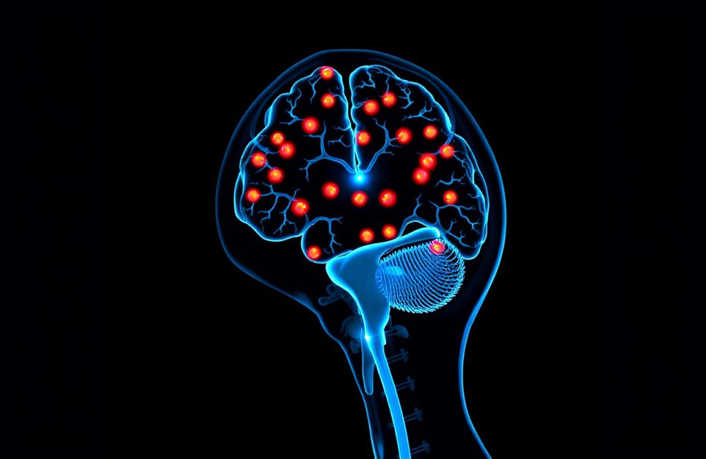 Enhancing Multiple Sclerosis Management by Detecting the Symptom-Free Phase