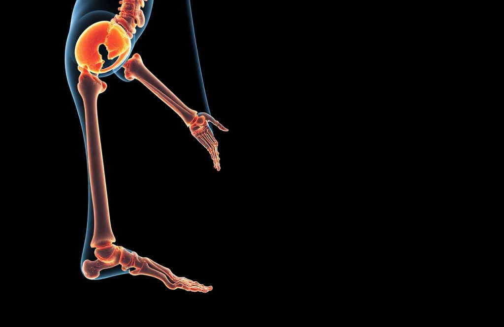 Canagliflozin and Fracture Risk: What Diabetics Need to Know