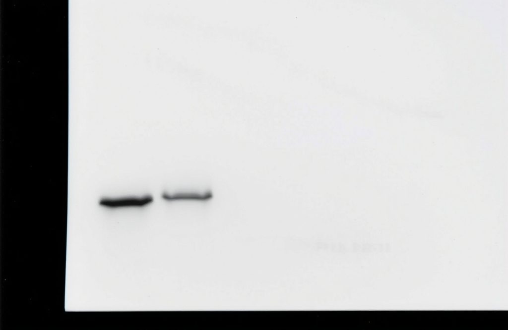 Mastering Western Blot: A Comprehensive Guide to Detecting Phosphoproteins