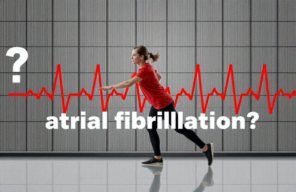 Exploring the Link Between Exercise and Atrial Fibrillation: What You Need to Know