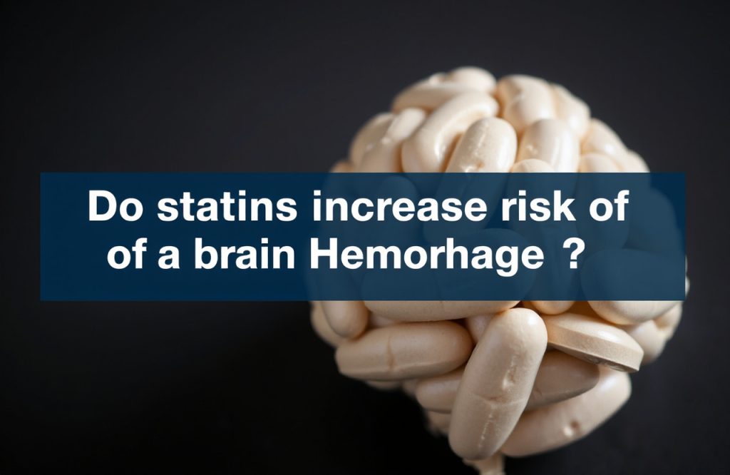 Exploring the Link Between Statins and Brain Hemorrhage Risk: What You Need to Know