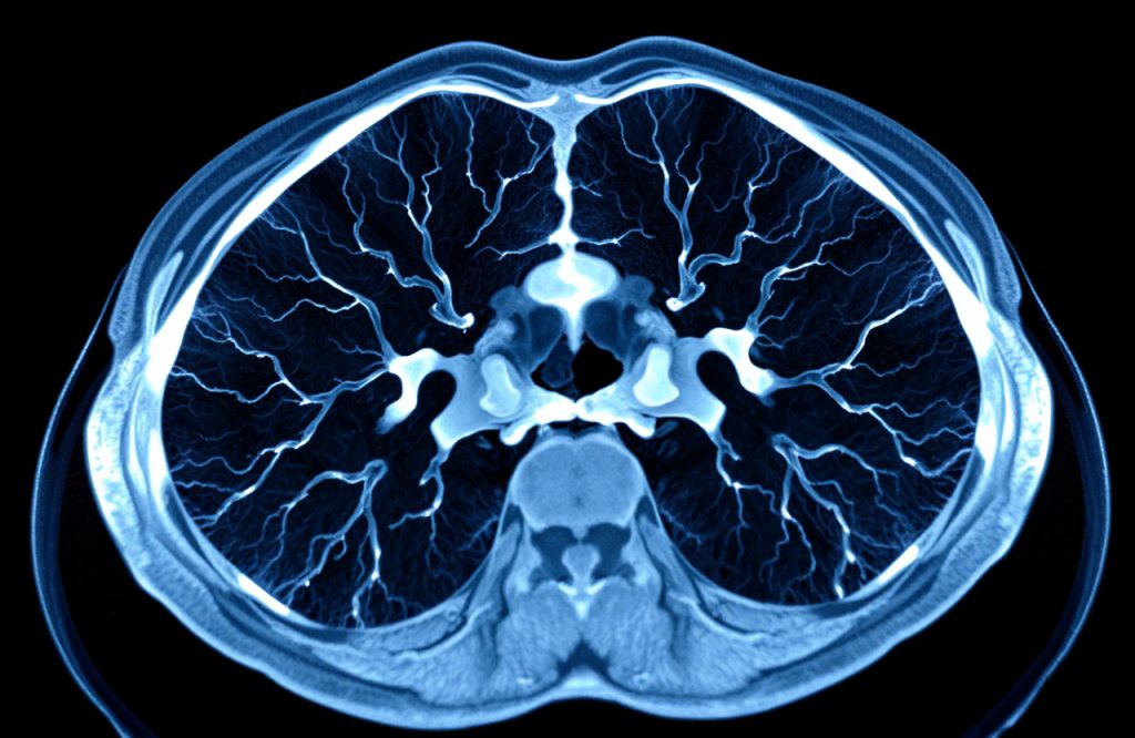 Harnessing AI in Medical Education to Alleviate Radiology Bottlenecks