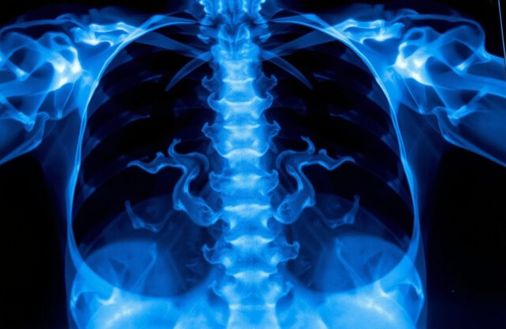 Hospital Staff Sacked in UP After Fake X-Ray Racket Exposed: Two Suspended and One Dismissed