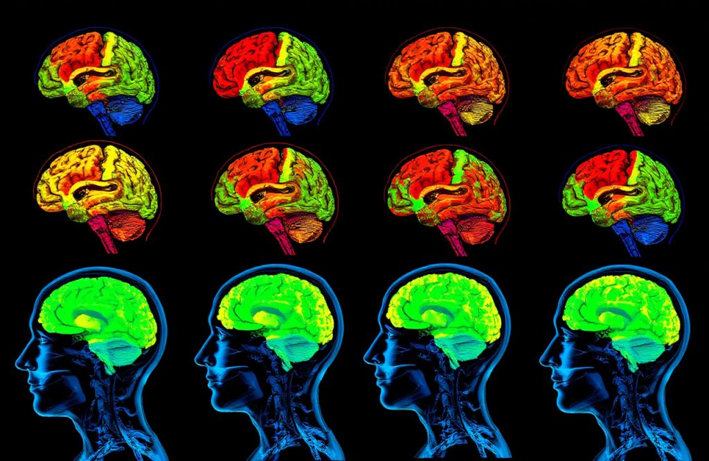 Revolutionary AI Model Enhances Early Dementia Warnings and Improves Brain Cancer Detection